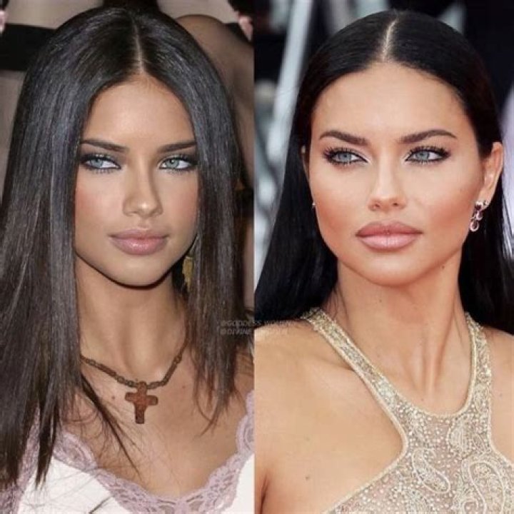 Adriana Lima Weight Loss Before And After; What Happened To Her? Health Update